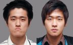 Before And After Of South Korean Cosmetic Surgery