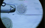 Egg in microscope