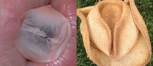 Vaginas