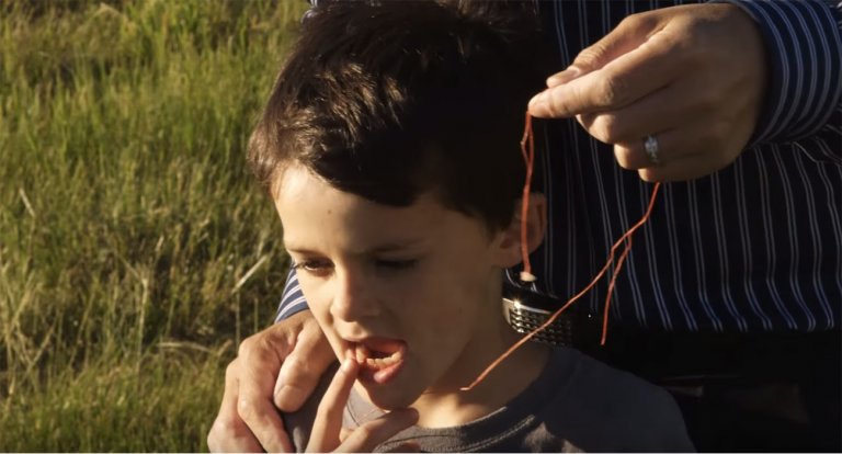 Dente elicottero