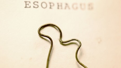 Gli oggetti più strani ingoiati dai bambini