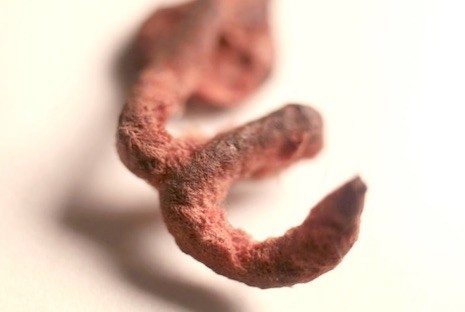 Gli oggetti più strani ingoiati dai bambini