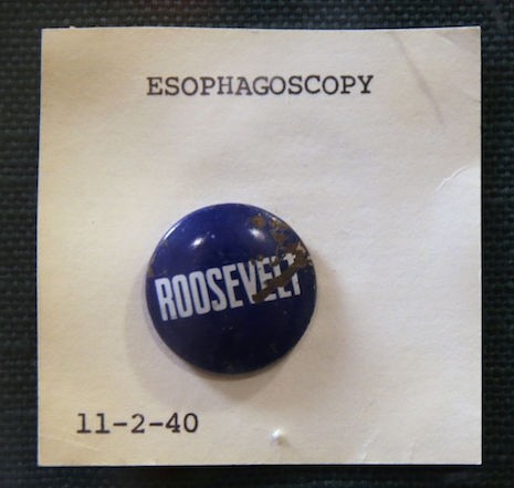 Gli oggetti più strani ingoiati dai bambini