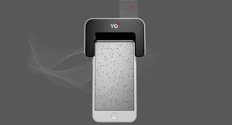 YO Sperm Test mette alla prova la tua fertilità con lo smartphone