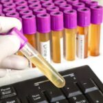 Schiuma nelle urine, problema