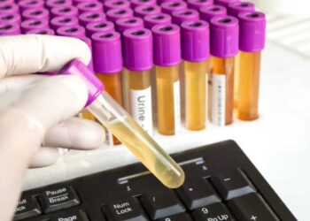 Schiuma nelle urine, problema