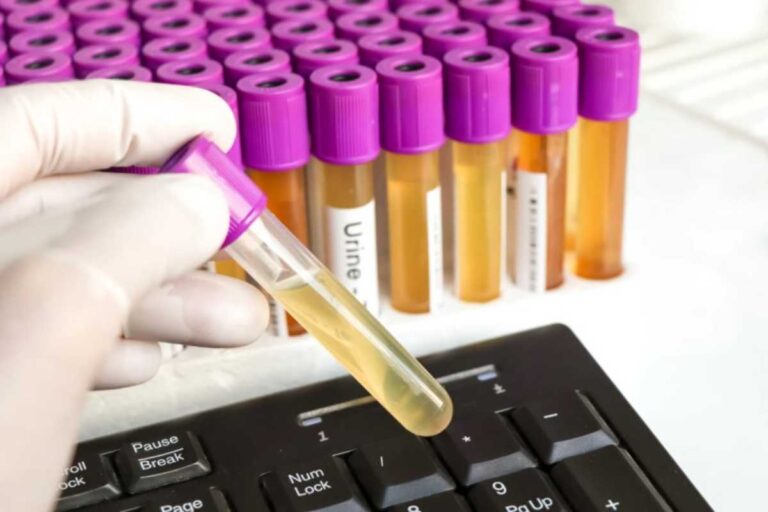 Schiuma nelle urine, problema