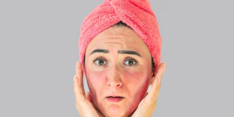 malattie della pelle estate