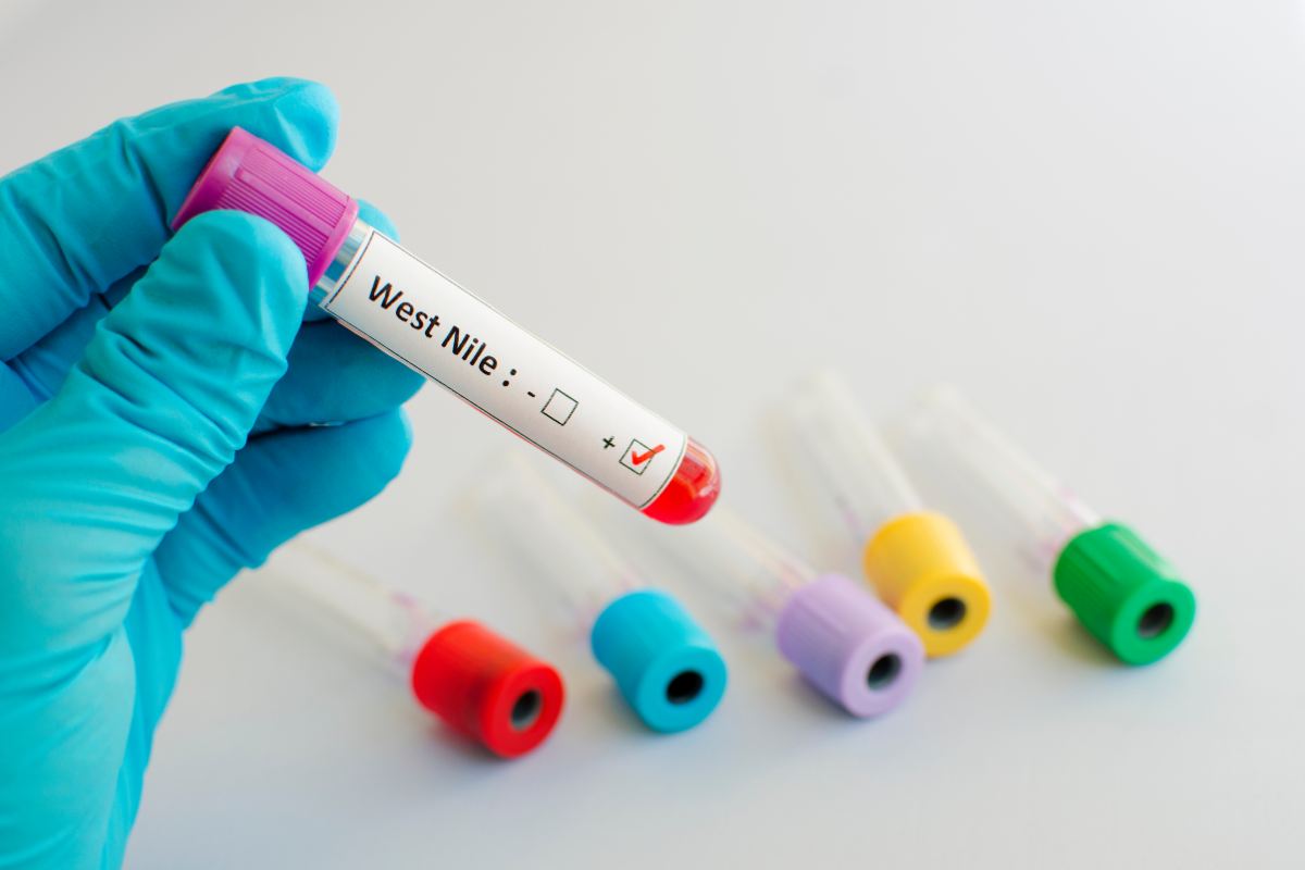 West Nile