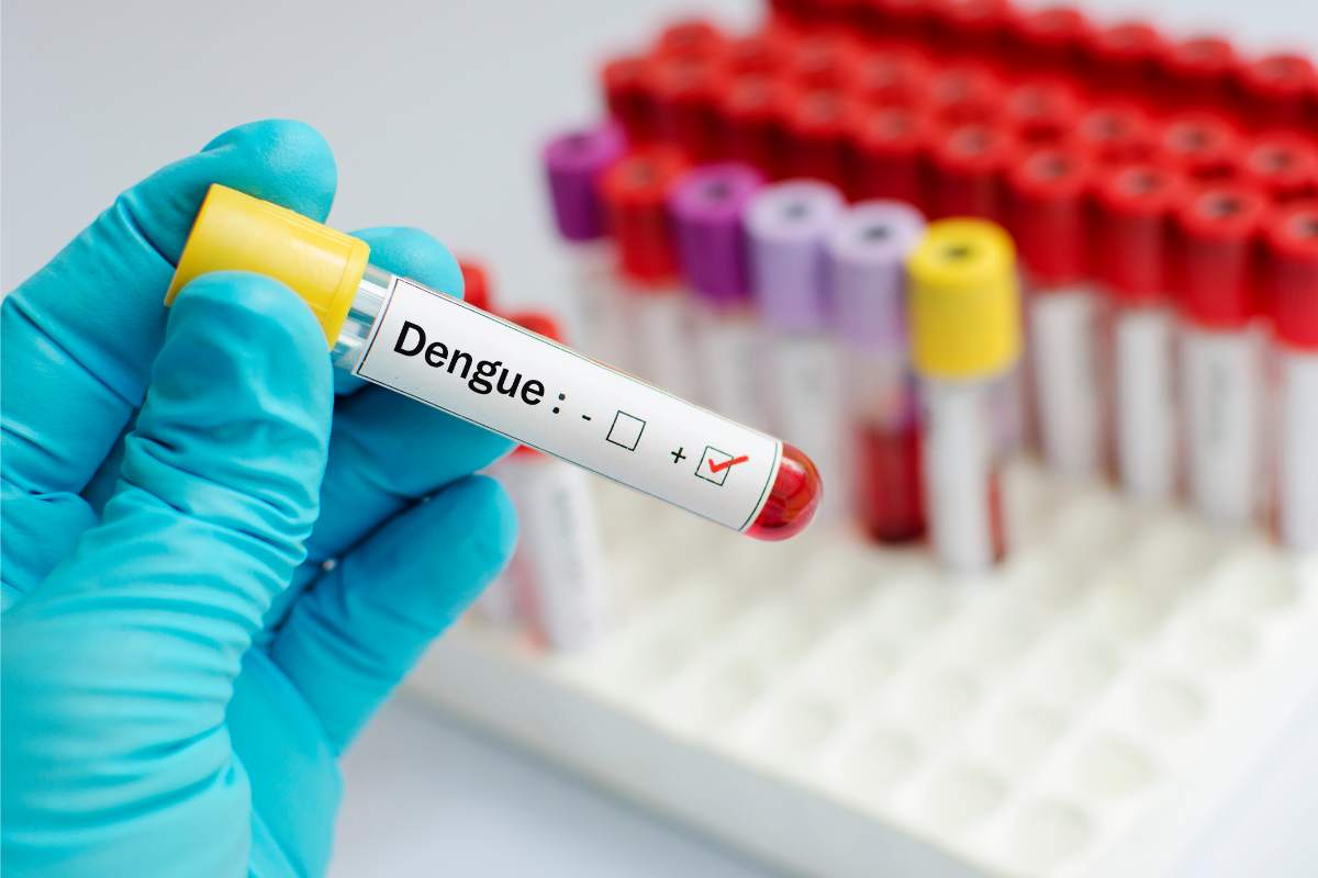Febbre Dengue