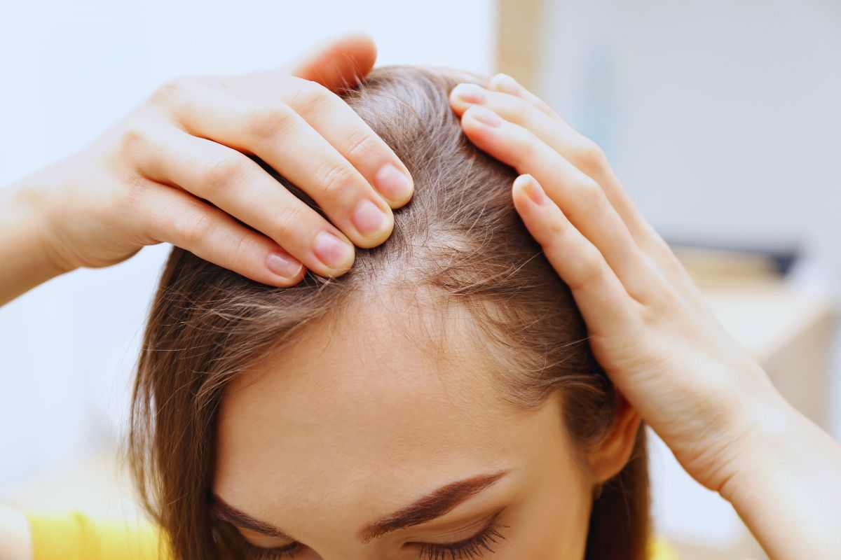come risolvere la caduta di capelli