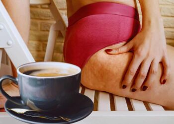 combattere la callulite con il caffè