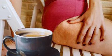 combattere la callulite con il caffè